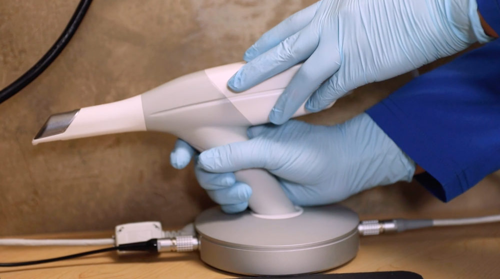 AAO scanning tips